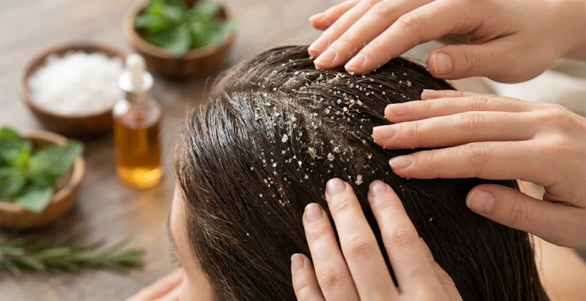 Mains massant un cuir chevelu avec un gommage au sel exfoliant près d'ingrédients naturels.
