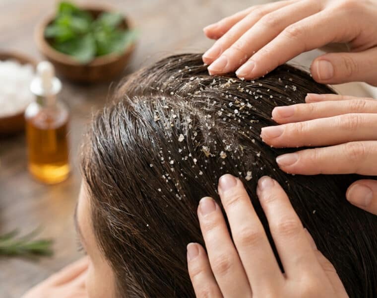 Mains massant un cuir chevelu avec un gommage au sel exfoliant près d'ingrédients naturels.